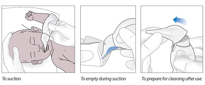 Penguin Suction Device | Products & Pricing