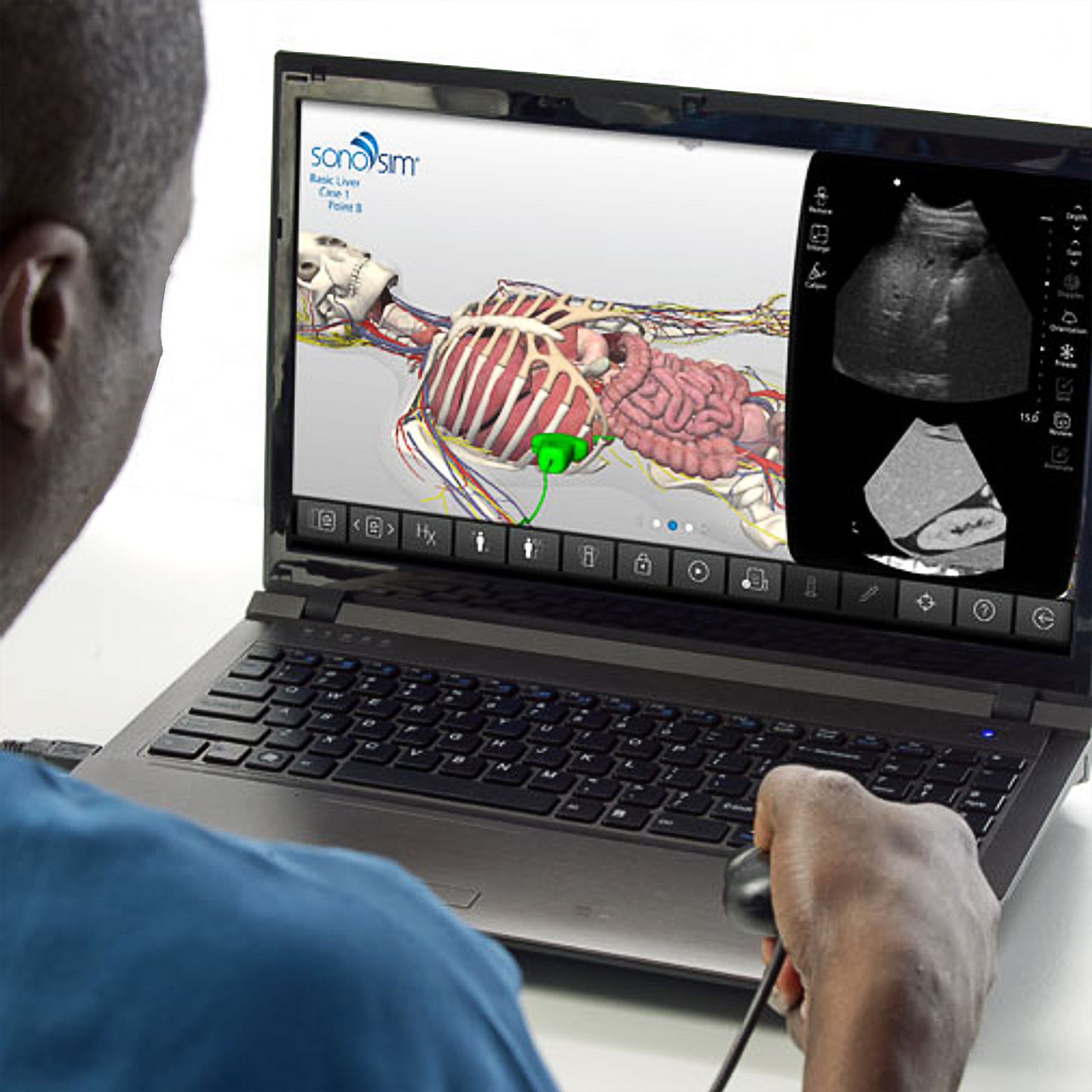 SonoSim Scan