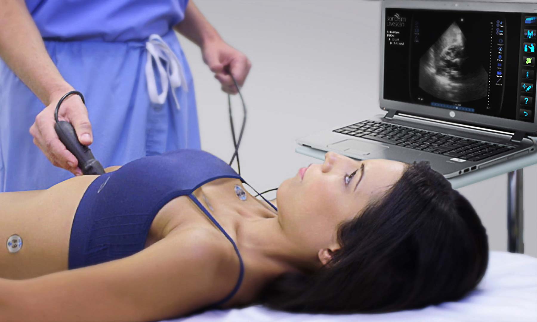 SonoSim Apply