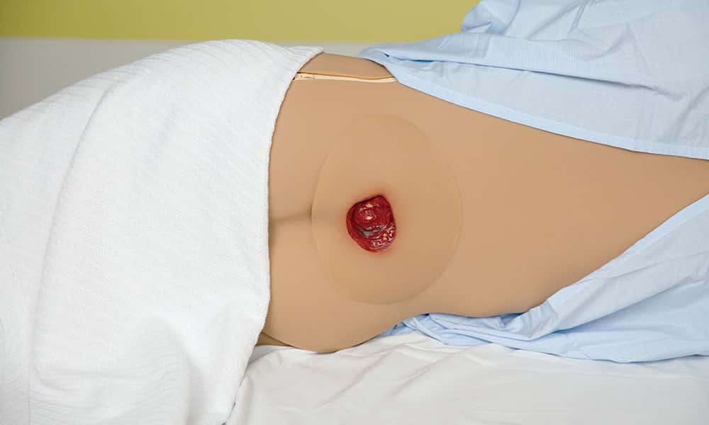 wound assessment