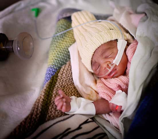 PrematureBaby_552.jpg