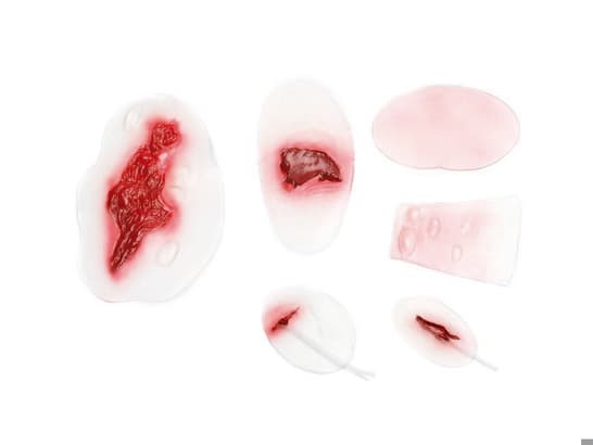 Wound selection 4