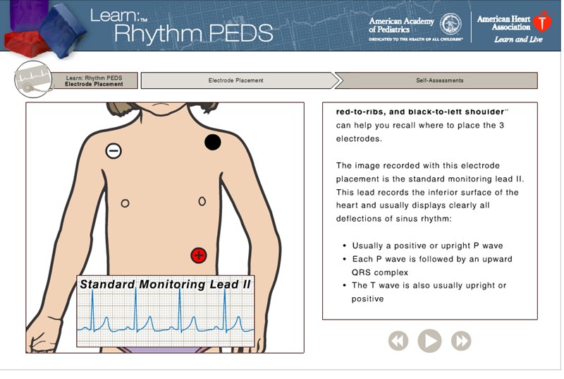 Learn:™ Rhythm Pediatric normal ekg diagram 