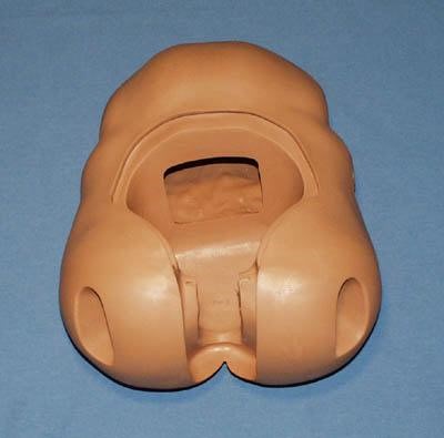 Pelvis, Hosp W/O Bridge