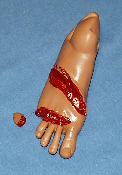 Foot, Adlt-Right-Crushed
