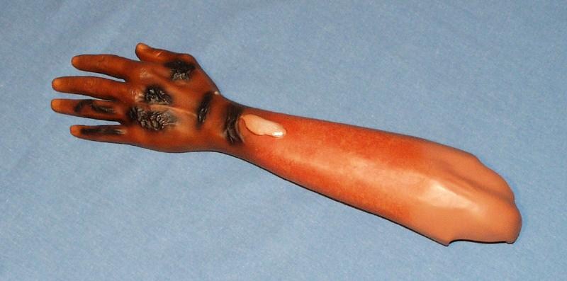 F/ARM; L-BURNT PNTD-TAN ADULT MALE