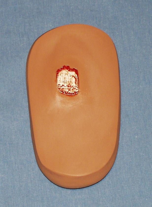 PAD; THIGH-OPEN FRAC-TAN ADULT PAINTED