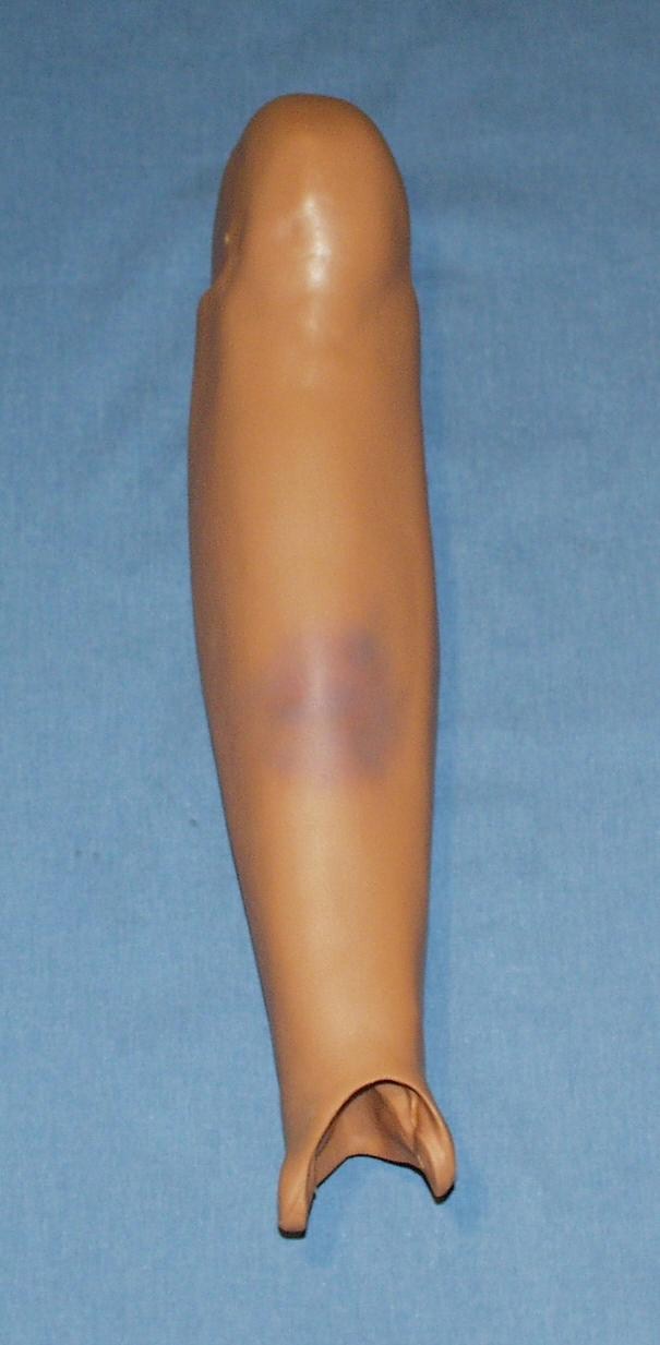 Leg Assy, Lower-Right W/Fracture