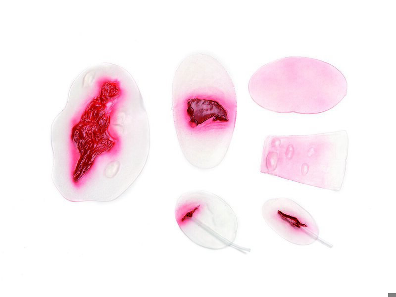 Assortiment Blessures No4