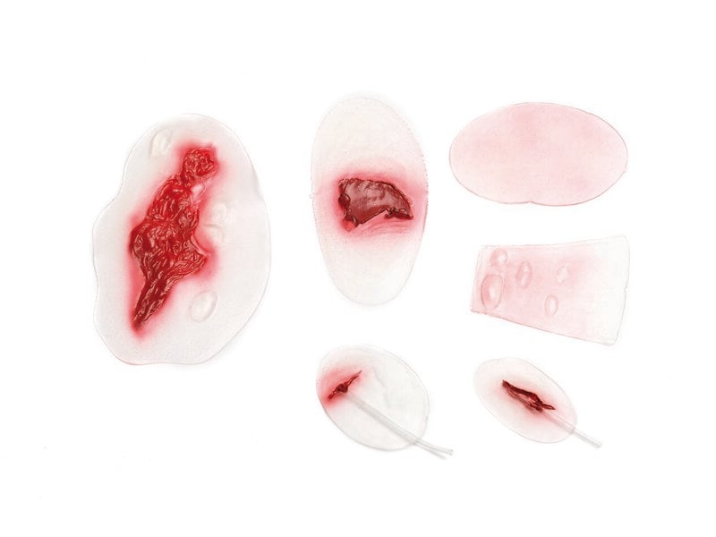 Wound selection 4