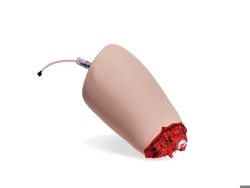 Amputiertes Bein (hellhäutig)