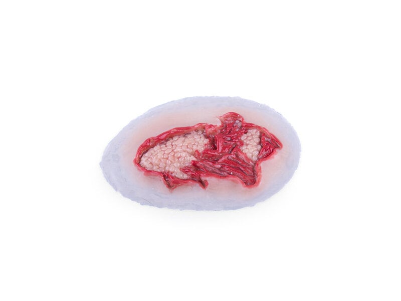 Deep Abrasion - Laerdal Light