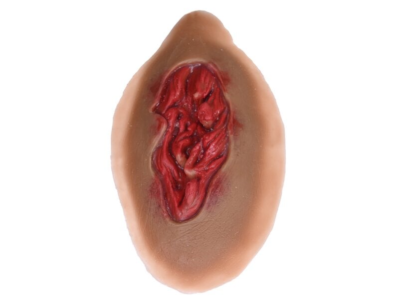 Large Lesion - Laerdal Dark