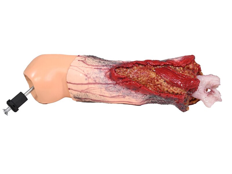 Complete Light left arm Amputation with Core