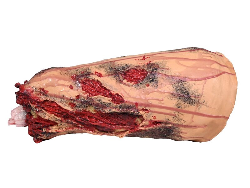 Complete Medium left leg Amputation with Core