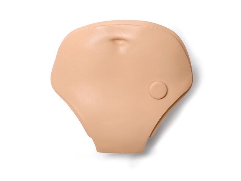 Plaque abdominale (1 stomie)