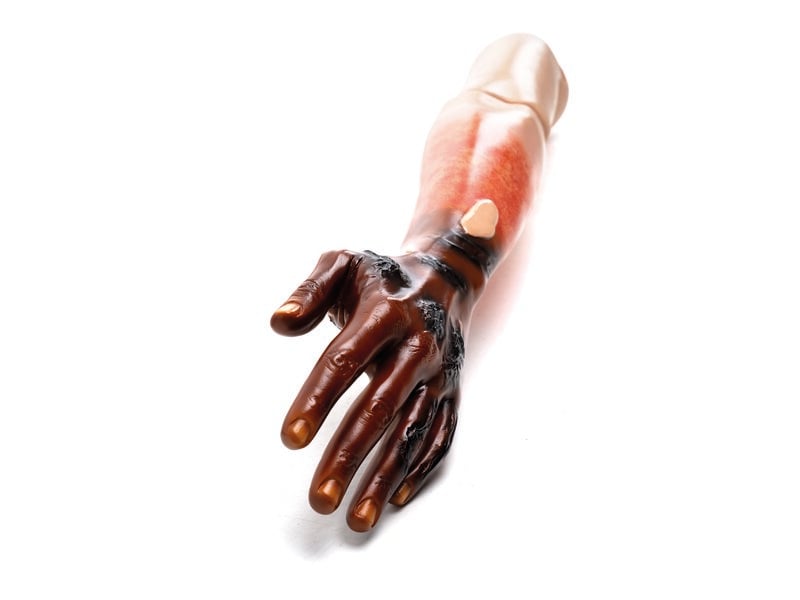 Arm Assembly, Left with Wounds