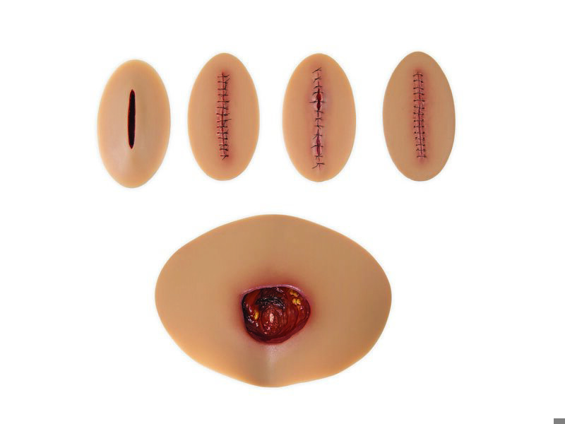 Kit évaluation de soins de plaie NAS - Couleur de peau medium