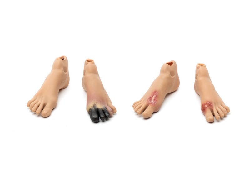 Staged Wound Feet Set-M NAS