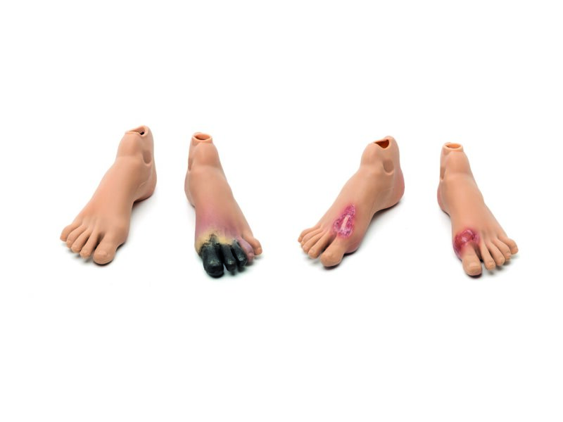 Staged Wound Feet Set-M NAS