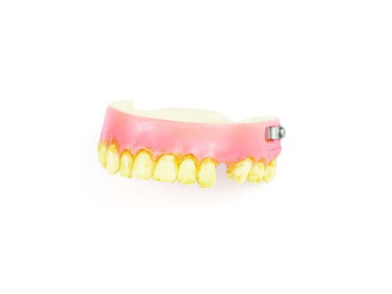 Dents supérieures