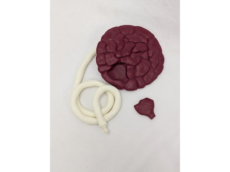 Fragmented Placenta MamaAnne