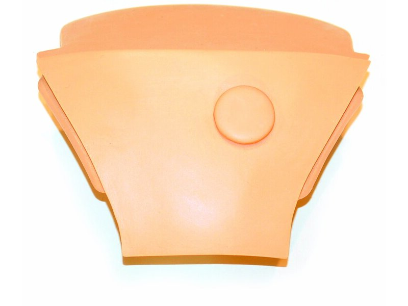 Plaque abdominale