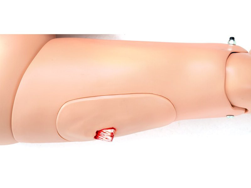 THIGH; ADLT BLEEDING (S)