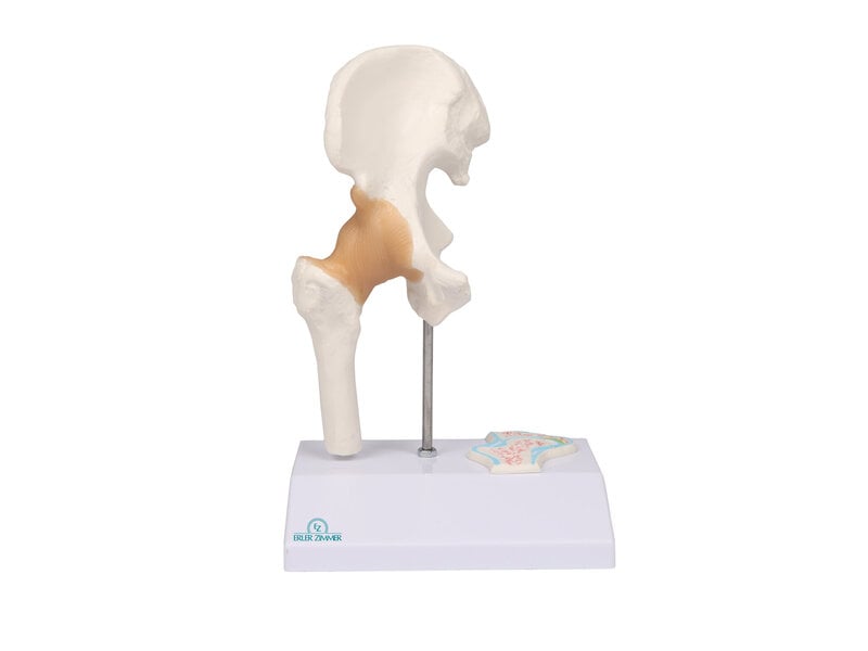 Articulation de hanche miniature 