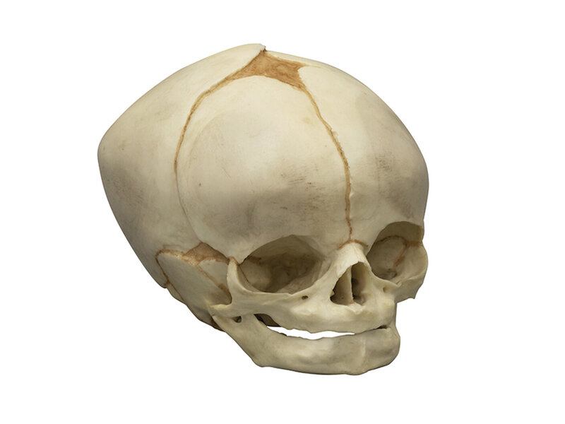 Fetal skull 40 ½ weeks