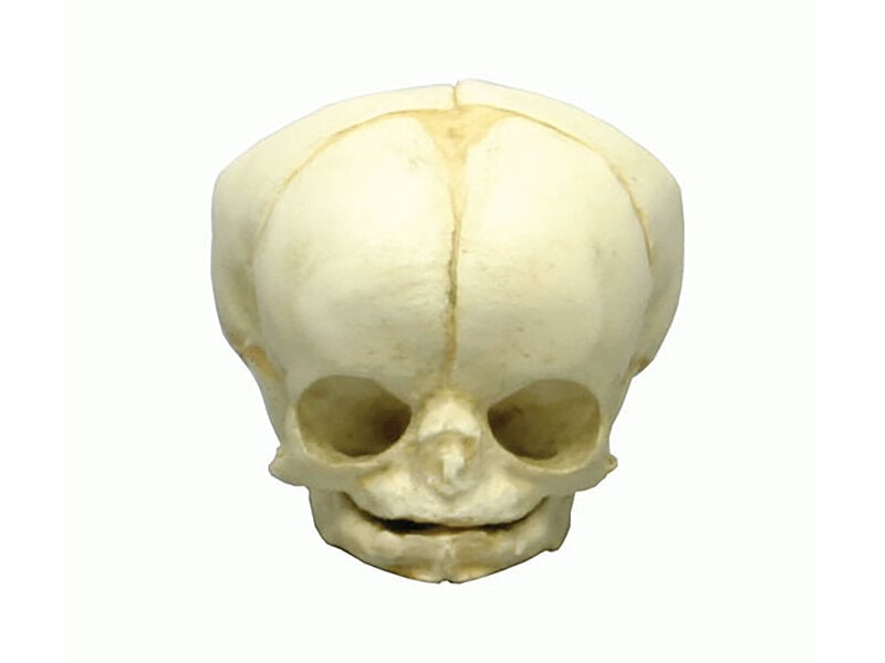 Fetal skull 35 weeks