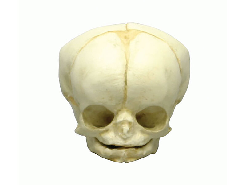 Fetal skull 35 weeks