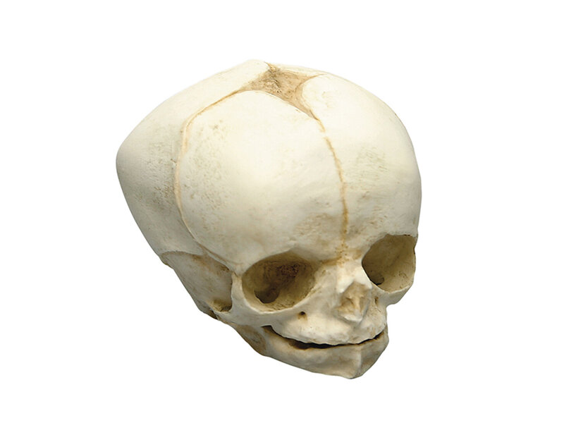 Fetal skull 34 weeks