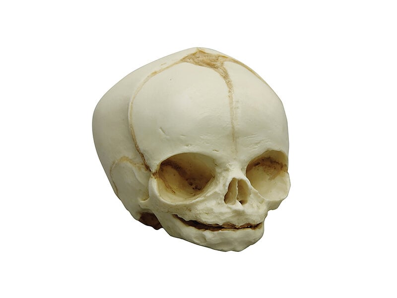 Fetal skull 31 weeks