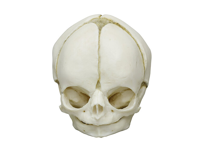Fetal skull 29 weeks