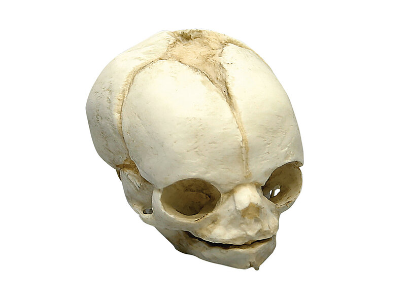 Fetal skull 21 ½ weeks