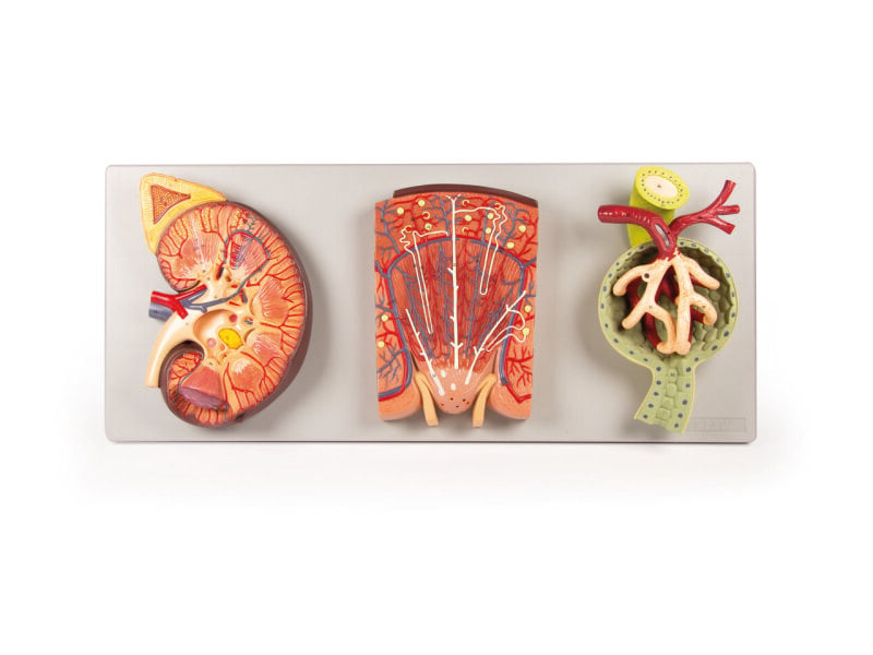 Kidney with Renal
