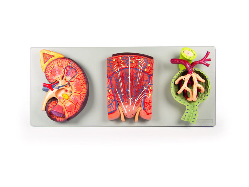 Kidney with Renal