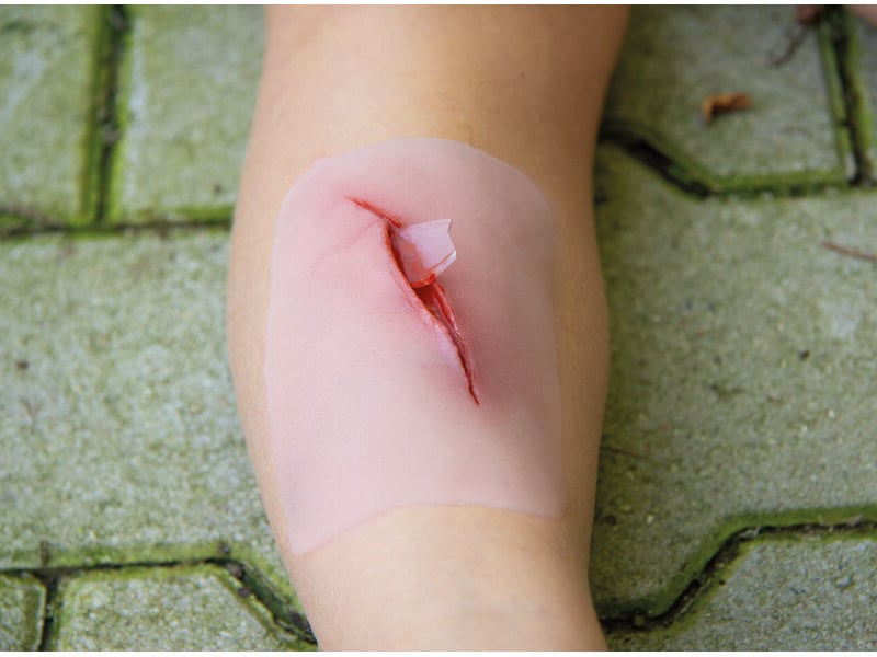 Cut with Glass Fragment