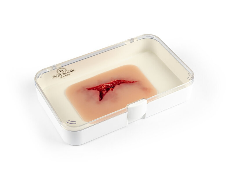 Laceration
