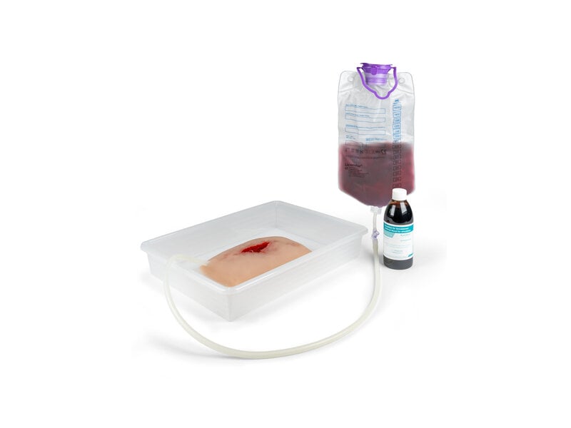 Wound Packing 