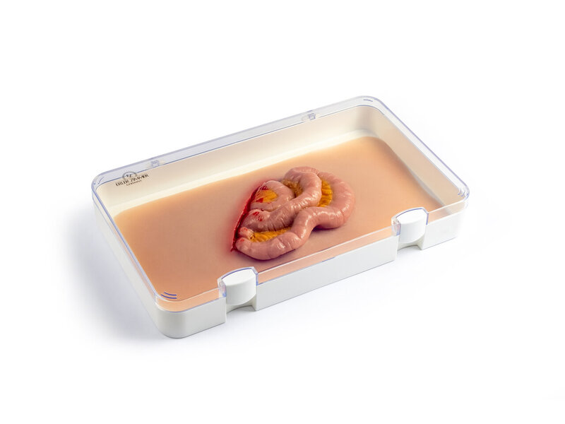 Protruding Intestines