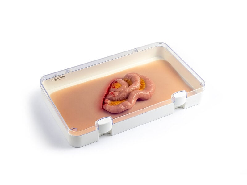 Protruding Intestines