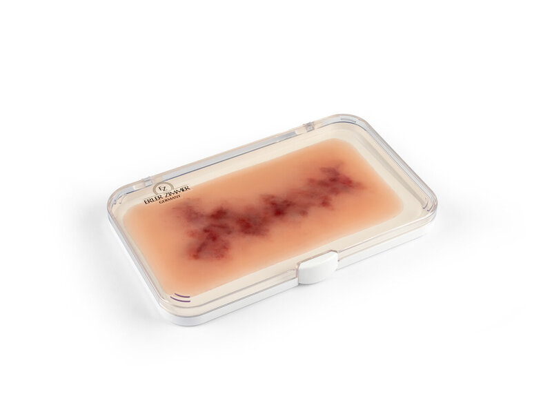 Hematoma Older
