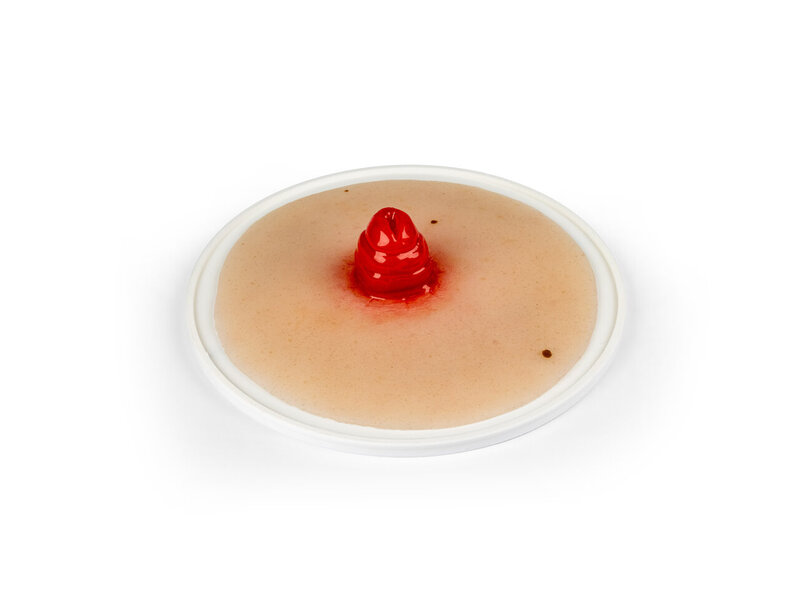 Self-Adhesive Ileostomy 