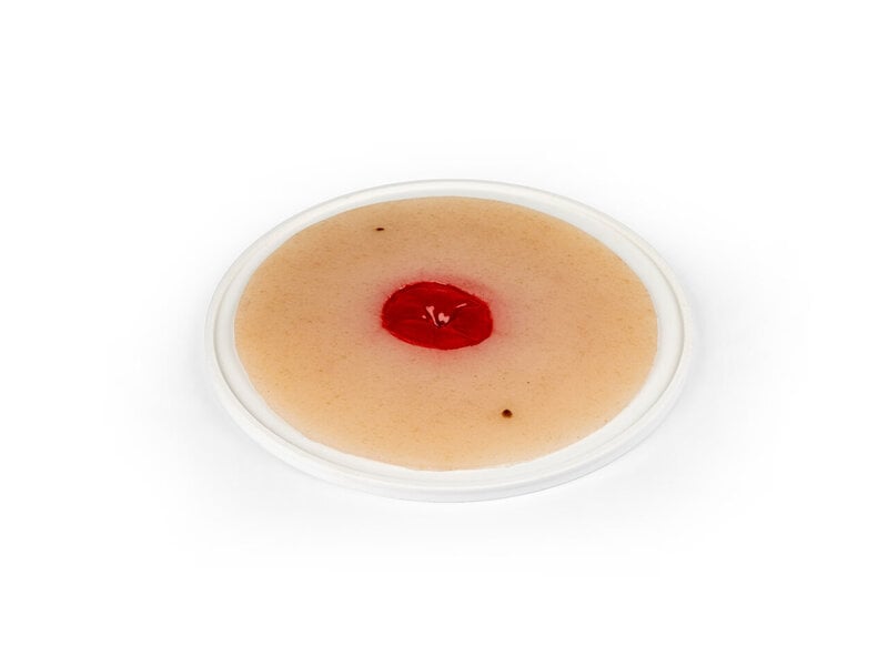 Colostomy Under Skin