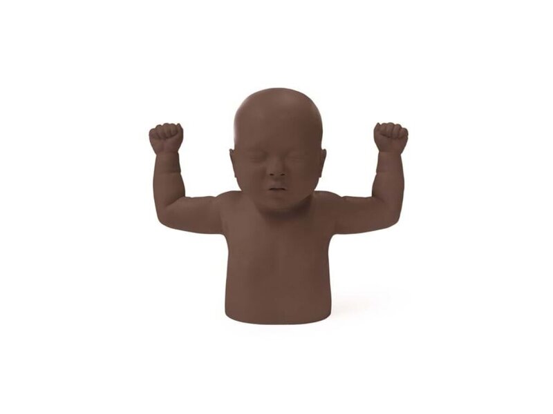 Infant Hip Exam - Upper - Dark