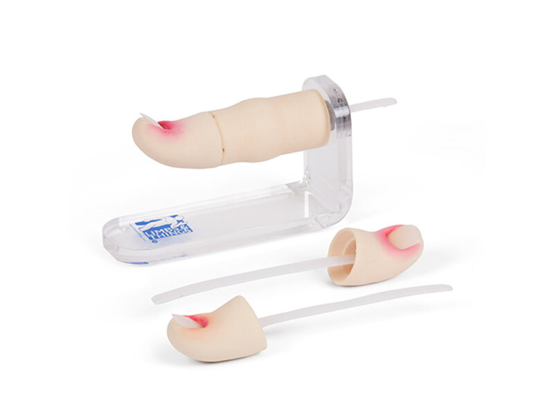 Ingrowing Toenail Trainer