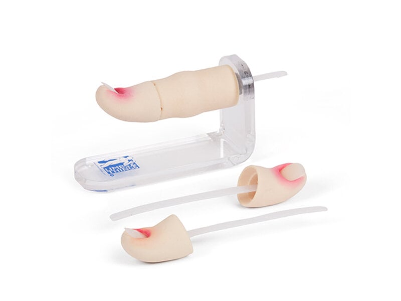 Ingrowing Toenail Trainer