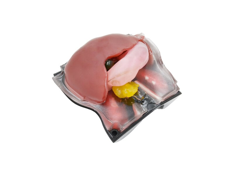 Abdominal Intraoperative & Laparoscopic Ultrasound Diagnosis Model (Opaque)